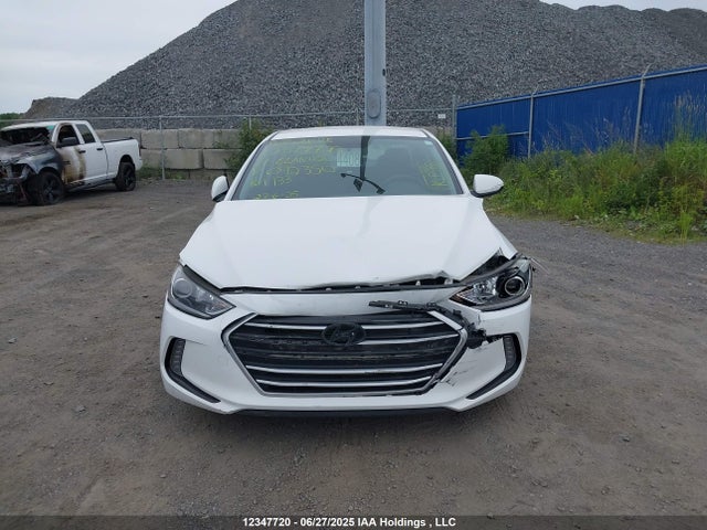 KMHD84LFXHU092350 Hyundai 2017