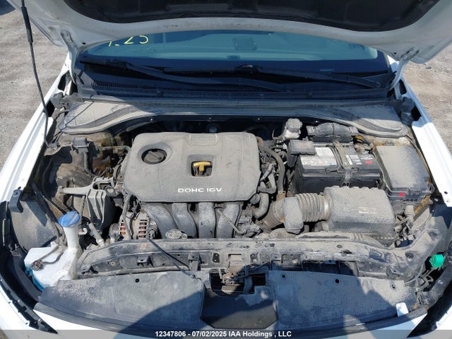 KMHD84LF5HU176835 Hyundai Elantra