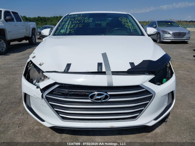 KMHD84LF5HU176835 Hyundai Elantra