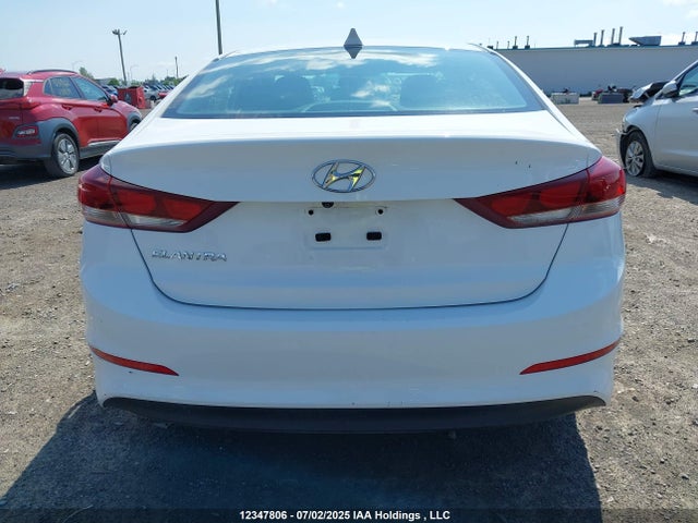 KMHD84LF5HU176835 Hyundai Elantra