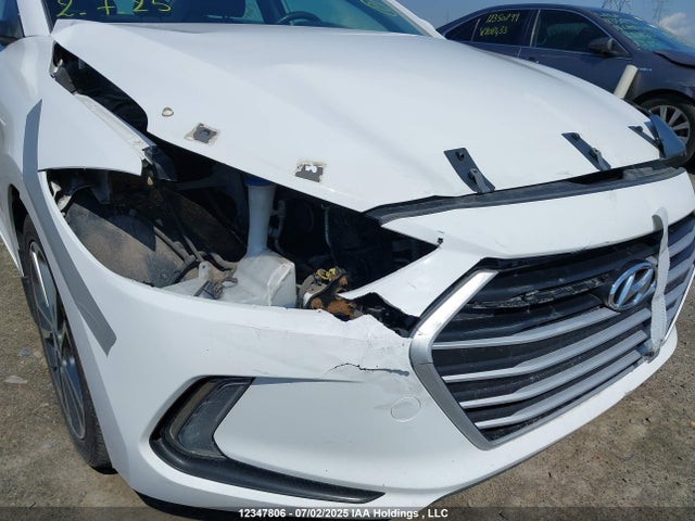 KMHD84LF5HU176835 Hyundai Elantra