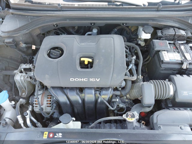 KMHD84LF1HU219308 Hyundai 2017