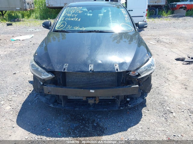 KMHD84LF3JU479604 Hyundai mpi nu