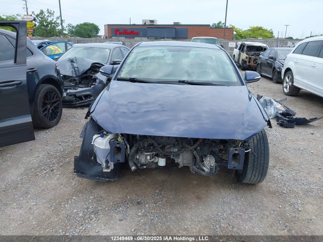 KMHD84LFXJU602170 Hyundai mpi nu