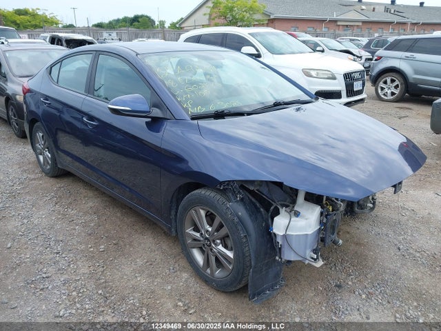 KMHD84LFXJU602170 Hyundai mpi nu