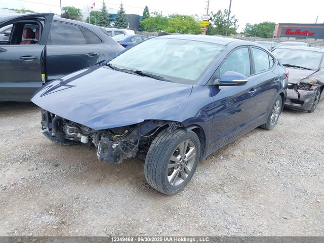 KMHD84LFXJU602170 Hyundai mpi nu