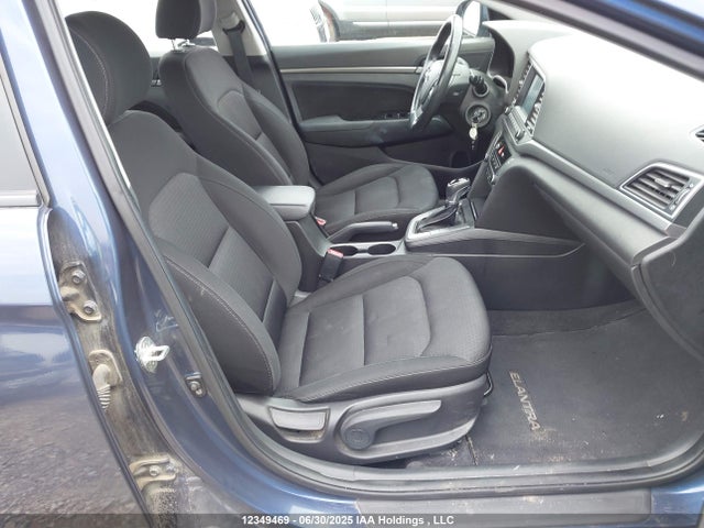 KMHD84LFXJU602170 Hyundai mpi nu