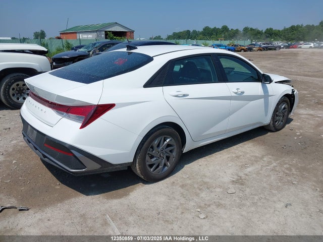 KMHLM4DG9RU739076 Hyundai mpi nu pe