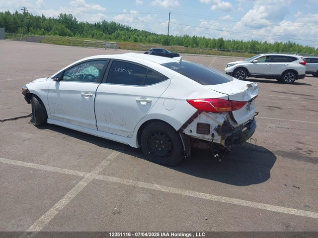 KMHD04LB0JU717204 Hyundai g 1.6 dohc t-gdi