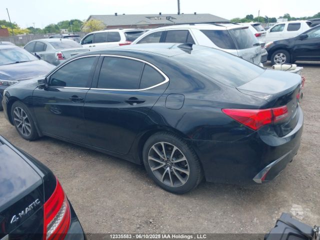 19UUB3F31KA802411 Acura j35y6