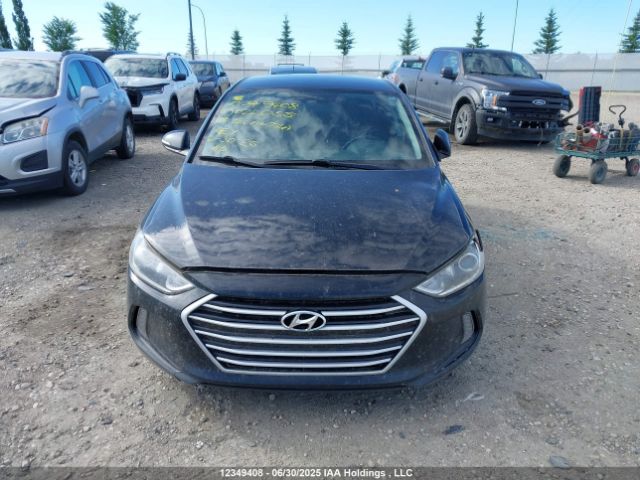 KMHD84LF0JU622055 Hyundai mpi nu