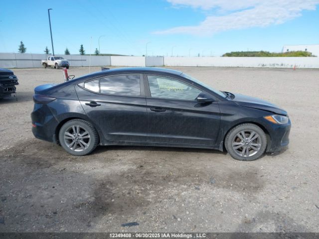 KMHD84LF0JU622055 Hyundai mpi nu