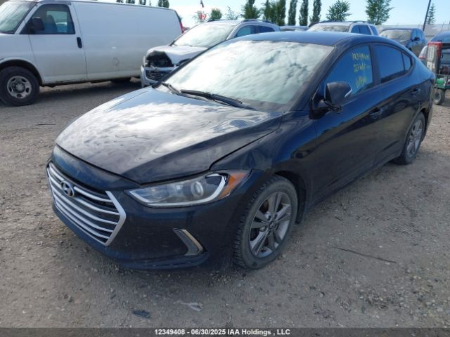 KMHD84LF0JU622055 Hyundai mpi nu