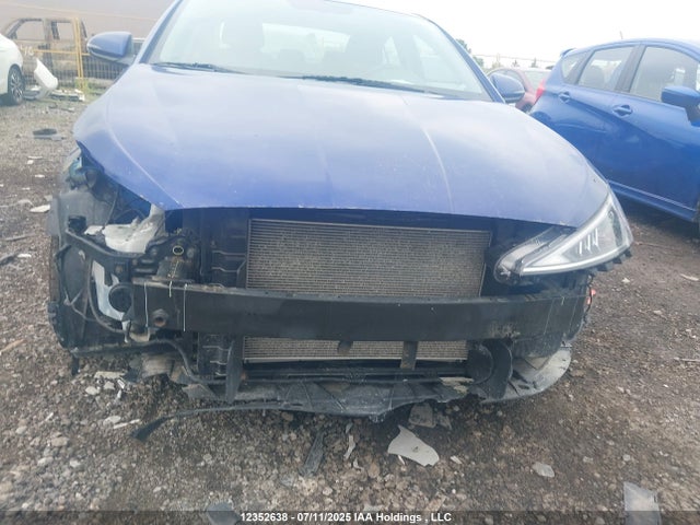 KMHD84LF4KU815391 Hyundai mpi nu