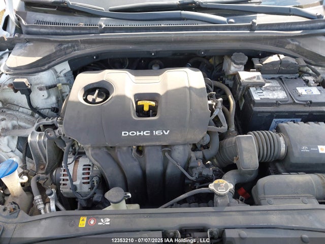 KMHD84LF0JU454630 Hyundai mpi nu