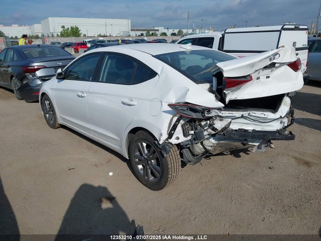 KMHD84LF0JU454630 Hyundai mpi nu