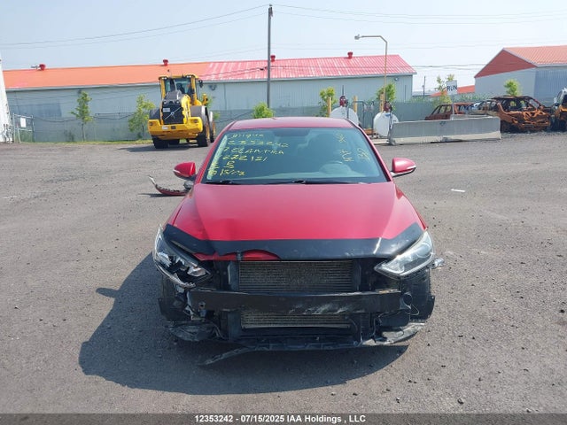 KMHD84LF6HU272151 Hyundai Elantra