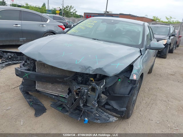 KMHLM4AG9NU277360 Hyundai mpi nu pe