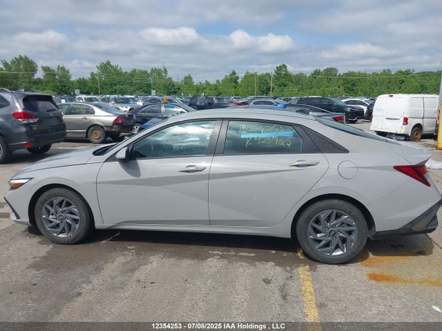 KMHLM4DG6SU928922 Hyundai mpi nu pe