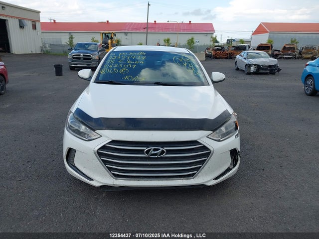 KMHD84LF3JU635091 Hyundai mpi nu