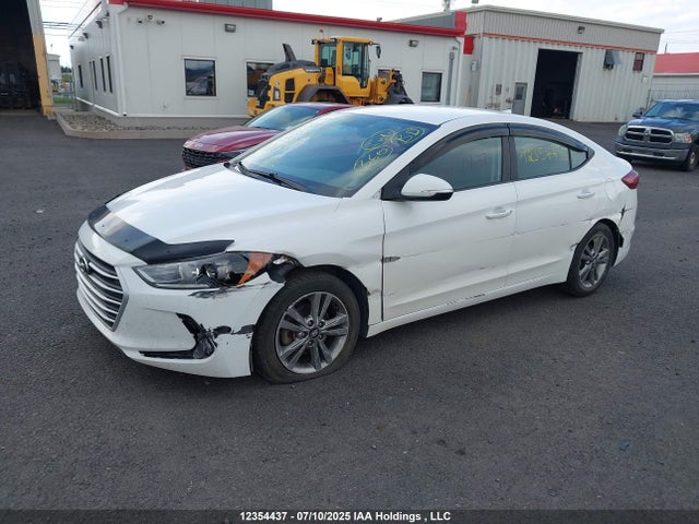 KMHD84LF3JU635091 Hyundai mpi nu
