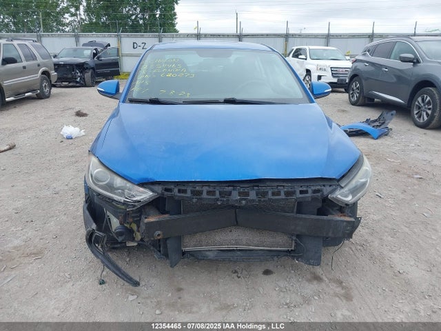 KMHD84LF0JU620273 Hyundai mpi nu