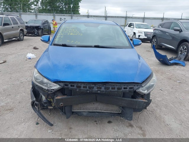 KMHD84LF0JU620273 Hyundai mpi nu