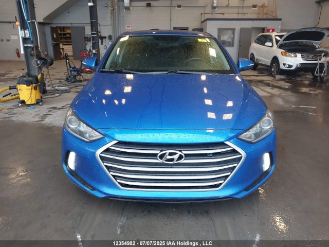 KMHD84LFXJU518270 Hyundai mpi nu