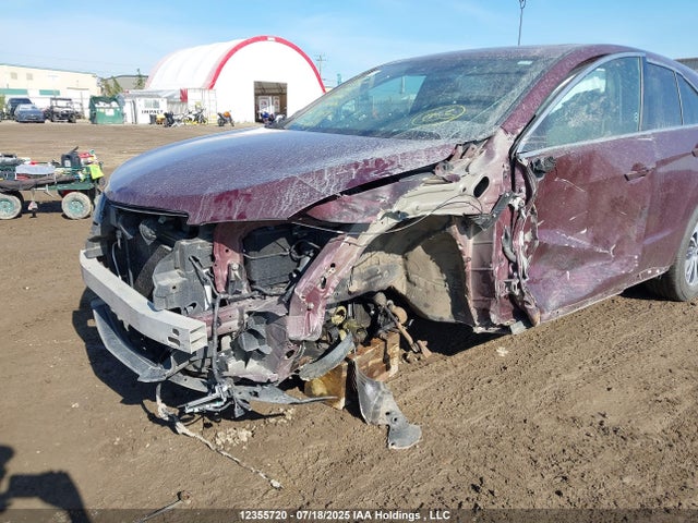 Acura j35z2 2016 5J8TB4H71GL804365 Image 6