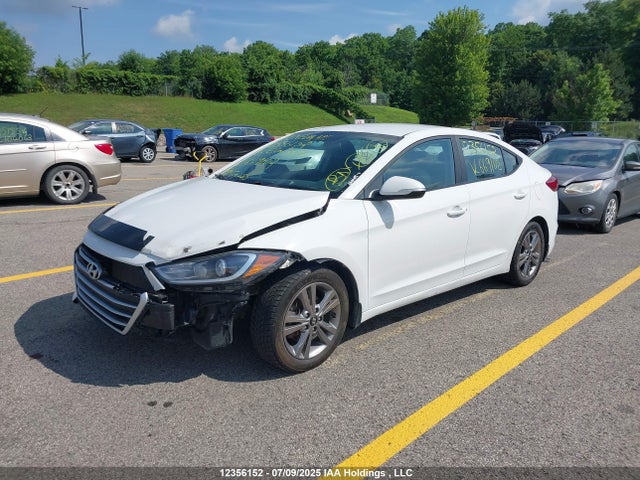 KMHD84LF9JU669102 Hyundai mpi nu