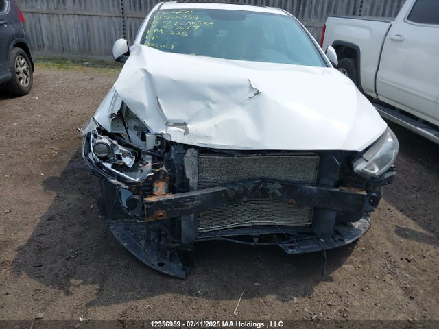 KMHD84LF2HU087627 Hyundai Elantra