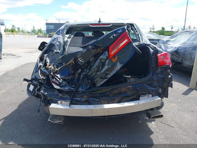19UUB1F54JA800043 Acura k24w7