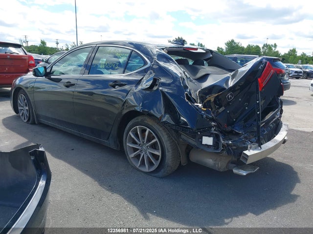 19UUB1F54JA800043 Acura k24w7