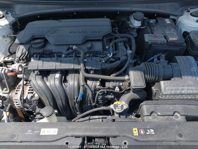KMHLM4AG5PU565024 Hyundai mpi nu pe