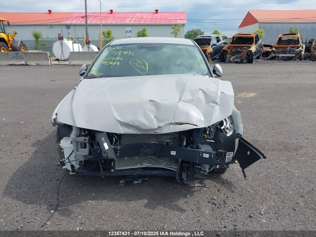 KMHLM4DGXSU993689 Hyundai mpi nu pe