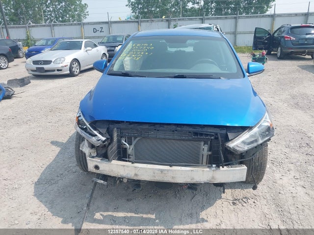 KMHC75LHXHU020831 Hyundai 2017