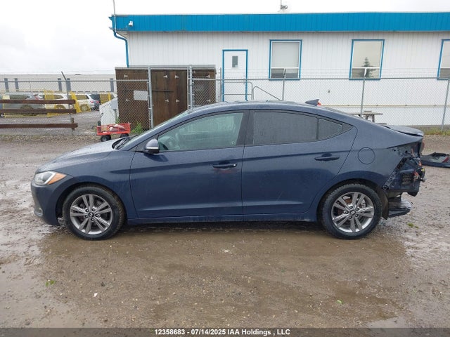 KMHD84LF3HU112521 Hyundai 2017