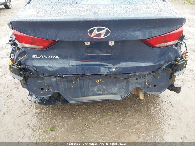 KMHD84LF3HU112521 Hyundai 2017