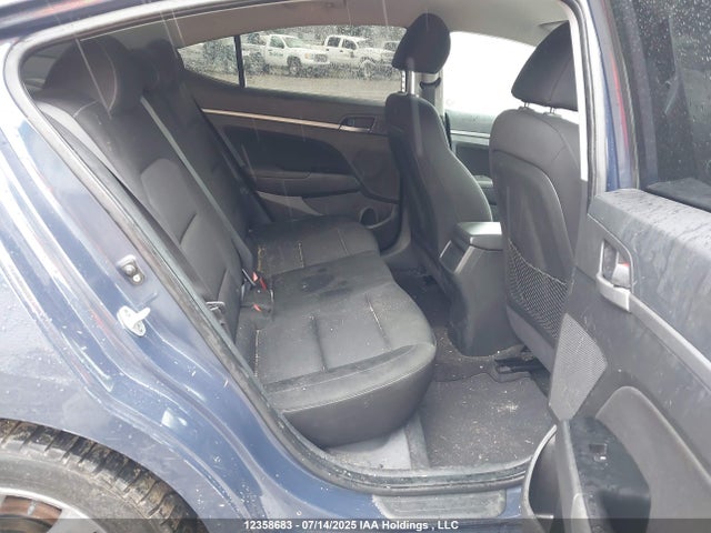KMHD84LF3HU112521 Hyundai 2017