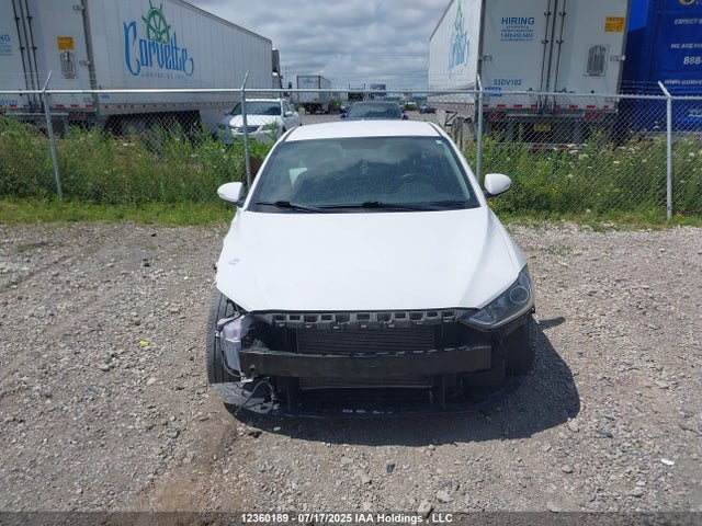 KMHD84LF4HU360079 Hyundai 2017