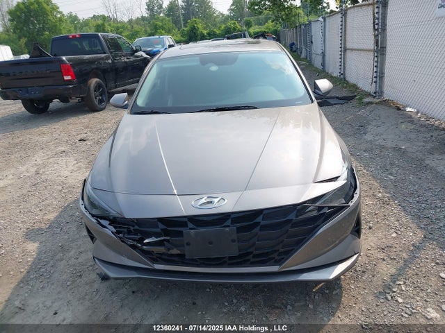 KMHLM4AG1PU387354 Hyundai mpi nu pe