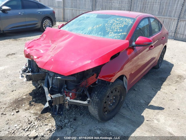 KMHD84LF9LU007068 Hyundai mpi nu