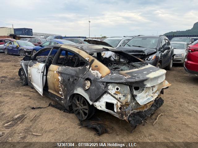 KMHD84LF9JU668869 Hyundai mpi nu