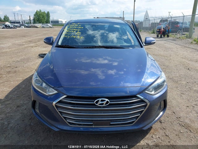 KMHD84LF5JU541505 Hyundai mpi nu