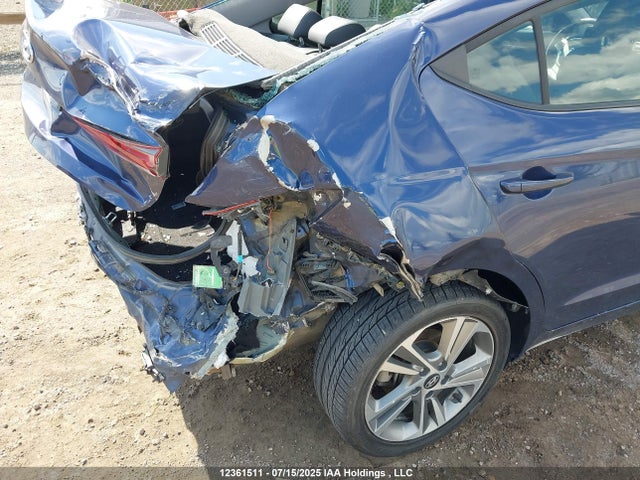 KMHD84LF5JU541505 Hyundai mpi nu