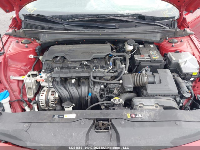 KMHLM4DGXRU825920 Hyundai mpi nu pe