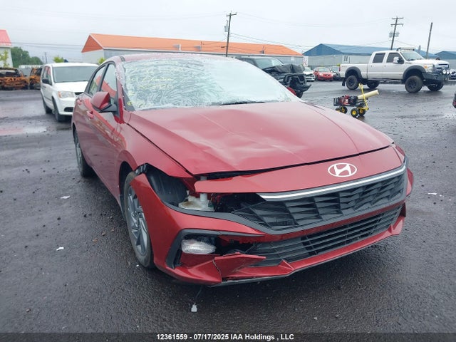 KMHLM4DGXRU825920 Hyundai mpi nu pe