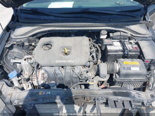 KMHD84LF6HU158411 Hyundai 2017