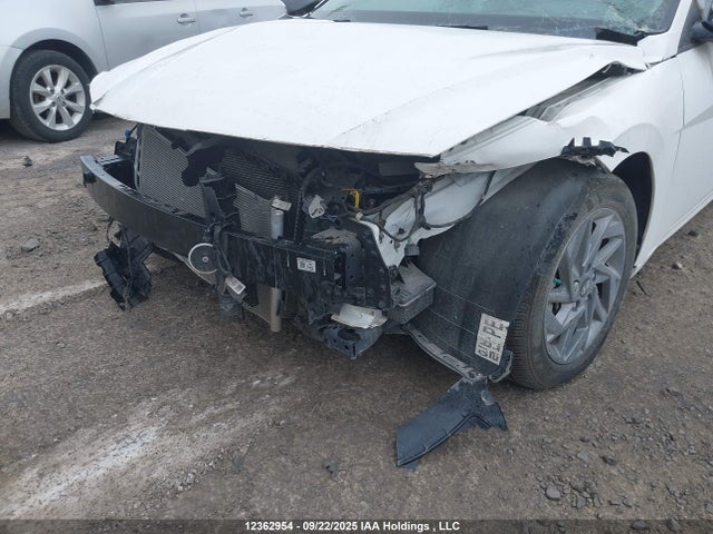 KMHLM4DG1RU826891 Hyundai mpi nu pe