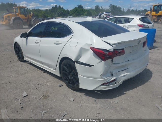 Acura Tlx Elite 2015 19UUB3F72FA800773 Image 25
